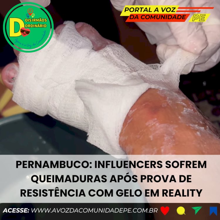 Influencers sofrem queimaduras após prova de resistência com gelo em reality