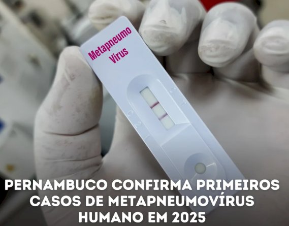 Pernambuco registra casos de Metapneumovírus Humano em 2025: Crianças recebem alta e SES-PE destaca prevenção