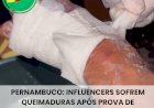 Influencers sofrem queimaduras após prova de resistência com gelo em reality